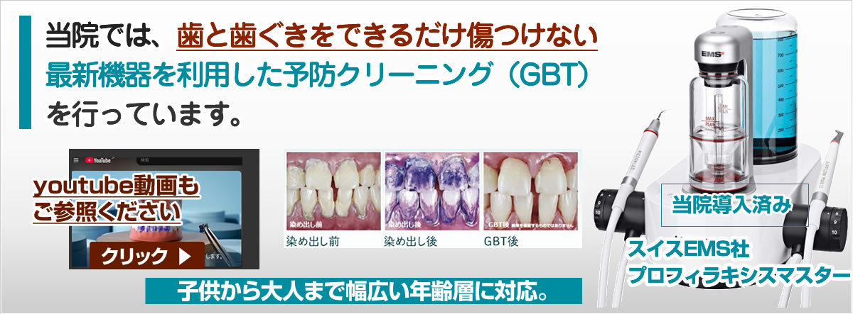 虫歯・歯周病の予防処置 エアフロープロキシスマスター